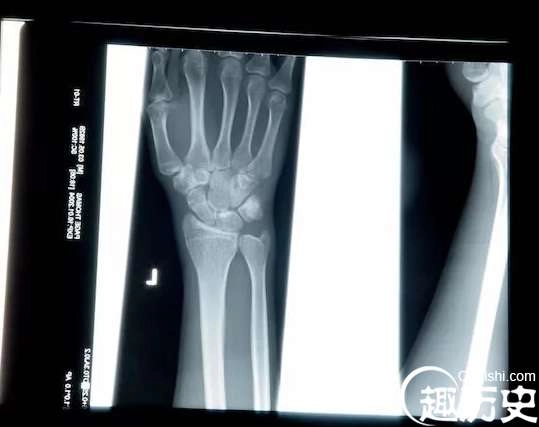 1525921764713891.png image.png