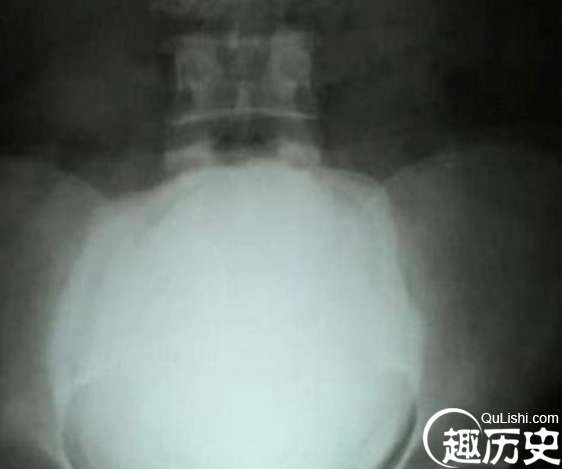 1524128814100251.png image.png