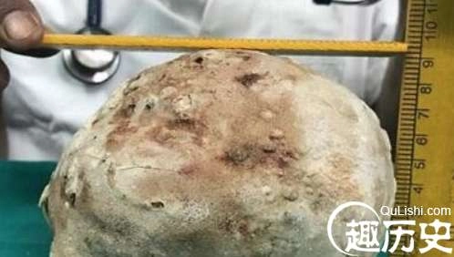 1524128795247202.png image.png